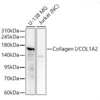 COL1A2 Rabbit Polyclonal Antibody