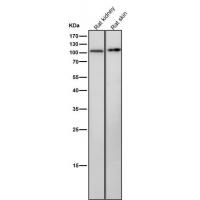 PKD1 Rabbit mAb