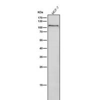 PKD1 Rabbit mAb