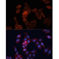 HSPB1 Antibody