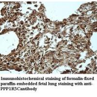 PPP1R3C Antibody