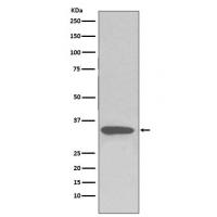 pro Caspase 3 Rabbit mAb