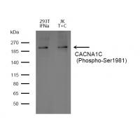 CACNA1C (Phospho-Ser1981) Antibody