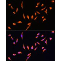 Vimentin Polyclonal Antibody