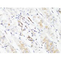 Vimentin Polyclonal Antibody