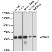 Vimentin Polyclonal Antibody