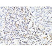 Vimentin Polyclonal Antibody