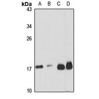 RPL32 Polyclonal Antibody