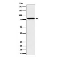 PRMT7 Rabbit mAb