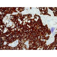 Cytokeratin Pan mouse mAb