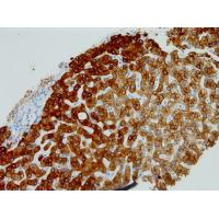 Cytokeratin Pan mouse mAb