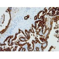 Cytokeratin Pan mouse mAb