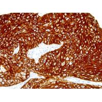 Cytokeratin Pan mouse mAb