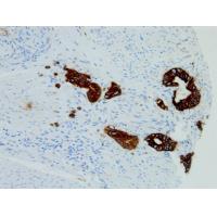 Cytokeratin Pan mouse mAb