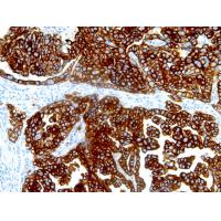 Cytokeratin Pan mouse mAb