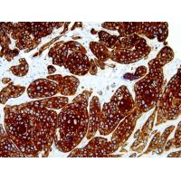 Cytokeratin Pan mouse mAb