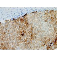 Cytokeratin Pan mouse mAb