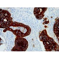 Cytokeratin Pan mouse mAb