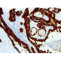 Cytokeratin Pan mouse mAb