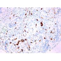 CD68 Mouse mAb