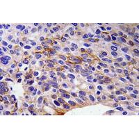 SEMA3A Polyclonal Antibody