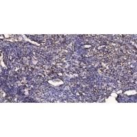 SKI-1 Polyclonal Antibody