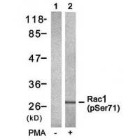 Rac1/CDC42 (Phospho Ser71) rabbit pAb