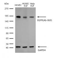 EGFR(Ab-869) Antibody