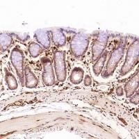 S100A4 Rabbit mAb