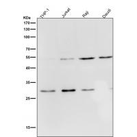 Parkin Rabbit mAb