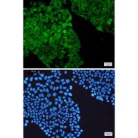 PGK1 Rabbit mAb