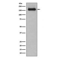 HDAC9 Rabbit mAb