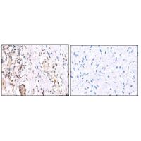 FOXP2 rabbit polyclonal antibody