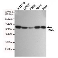 PKM2 mouse mAb