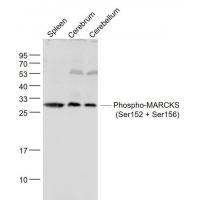 MARCKS (Phospho-Ser152 + Ser156) Antibody HRP Conjugated