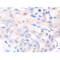 SOCS6 Antibody